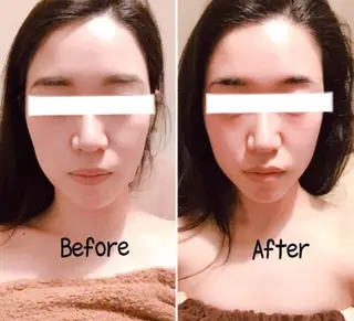 ビューティーサロン　サランブル所属・肌質改善エステサロン サランブルのエステ・リラクイメージ