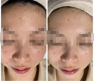 De I'm トータルビューティーサロン所属・COCO beautyサロンのエステ・リラクイメージ