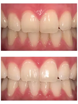 LOVE ホワイトニング渋谷のその他イメージ