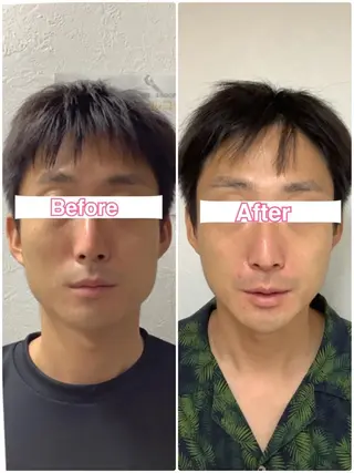 美容鍼・整体サロン アネモネ🌸心斎橋のエステ・リラクイメージ