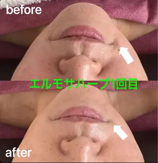 氣楽所属・松下 さゆりのエステ・リラクイメージ