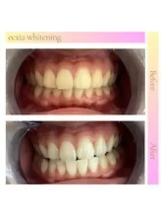 セルフホワイトニング エクシア西宮北口店所属・セルフホワイトニング エクシア西宮北口店のその他イメージ