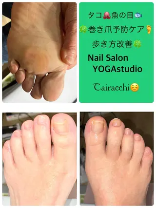 ネイル Tairacchi ﾀｲﾗｯﾁのエステ・リラクイメージ