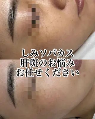 肌管理専門店 Shandeelのエステ・リラクイメージ