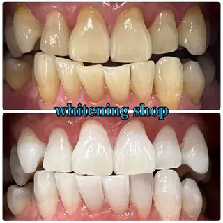 ホワイトニング ショップ吉祥寺店のエステ・リラクイメージ