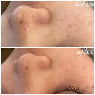 メンズ メナード岐阜市茜部 杉浦のエステ・リラクイメージ