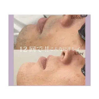 【folche】 フジイのエステ・リラクイメージ