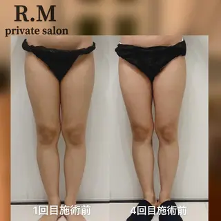 R.M所属・プライベートサロン R.Mのエステ・リラクイメージ