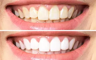 アイブロウ CHARMER🌹 Naokoのマツエク・マツパデザイン