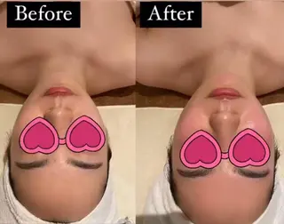 MENARD BLOOMのエステ・リラクイメージ