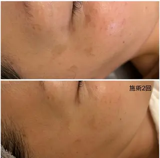 シミケア専門店 HAQUAのその他イメージ