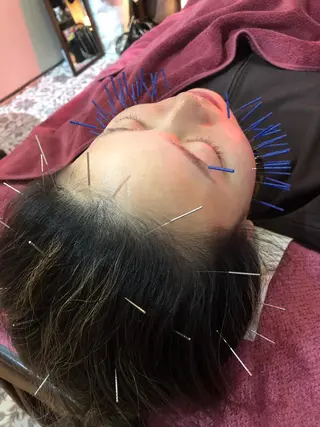 美容鍼灸女性専用 りんご鍼灸治療院のエステ・リラクイメージ