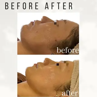 Beauty salon ハピー所属・大人女性のための 肌管理サロン　ハピーのエステ・リラクイメージ