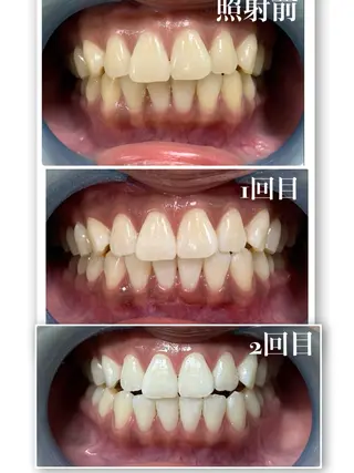 𝐑𝐞𝐯𝐢𝐨 ___堺市西区のマツエク・マツパデザイン