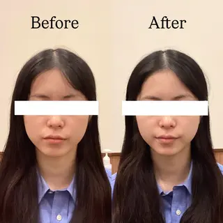 Hari Lounge恵比寿所属・chika🦋 ハリラウンジ恵比寿のエステ・リラクイメージ