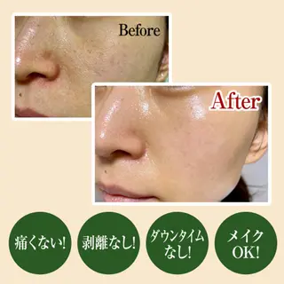 ユニーク ビューティーサロンのエステ・リラクイメージ