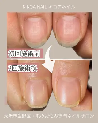 ネイル KIKOA NAIL キコアネイルのネイルデザイン
