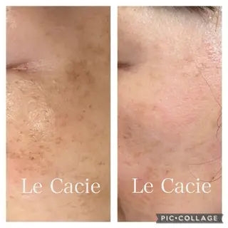 肌管理サロン ル・カシエのエステ・リラクイメージ