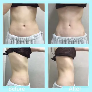 腸活SALON LANI所属・腸もみ＊腸活サロン 池袋＊norieのエステ・リラクイメージ