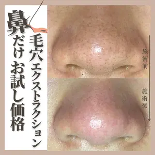 Muqu.所属・Muqu. 毛穴サロンのエステ・リラクイメージ