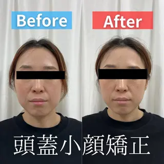 KOGAO STUDIO所属・モテギ ハルトのエステ・リラクイメージ