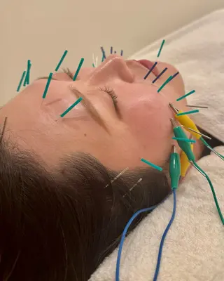 Ayaka🤍 恵比寿/美容鍼/整体のエステ・リラクイメージ