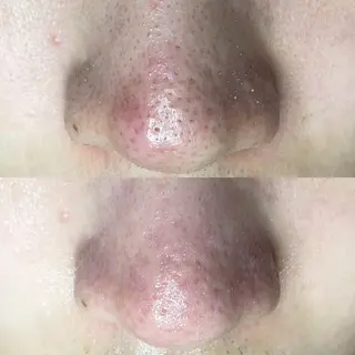 毛穴専門店MeMe.八千代店所属・\毛穴・頭皮/ のお悩みに特化💪のその他イメージ