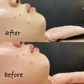 🫧美しい素肌へ🫧 今成柚乃のその他イメージ