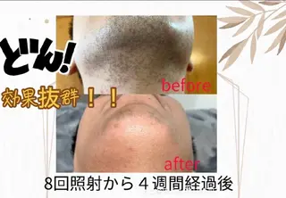 LOUISE.／脱毛所属・LOUISE. ／脱毛のエステ・リラクイメージ