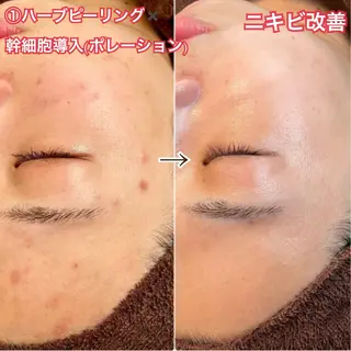 LAESSE 恵比寿所属・毛穴と美白の専門店 LAESSE 恵比寿のエステ・リラクイメージ