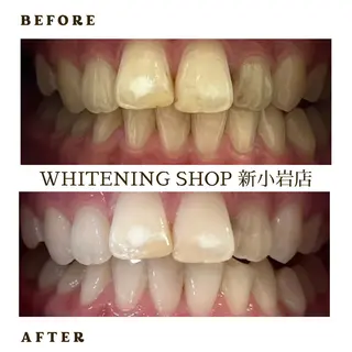 メンズ ホワイトニング ショップ新小岩店のその他イメージ