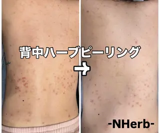 NHerb【エヌハーブ】所属・横田 汐里のエステ・リラクイメージ