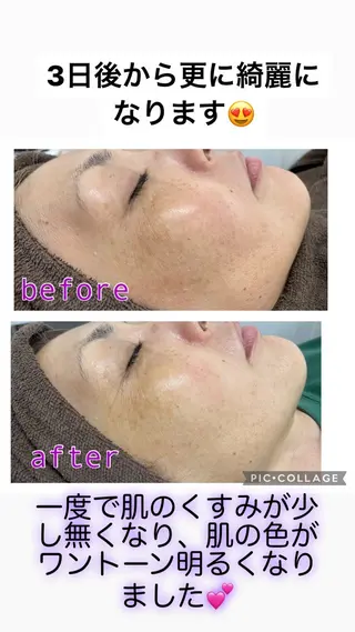 total beauty salon RIRE所属・古川 弥生のエステ・リラクイメージ