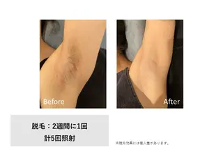 RIKKA所属・RIKKA☆脱毛/ アイブロウ/メイクのエステ・リラクイメージ