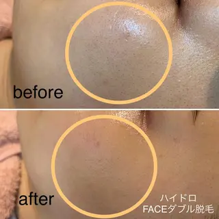 脱毛＆エステサロン JIGGLY☆松田のエステ・リラクイメージ