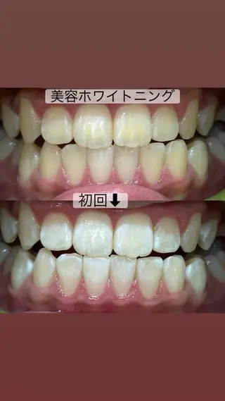 whitening salon yatto.所属・ホワイトニングサロン yatto.のその他イメージ
