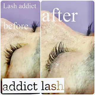 マツエク・マツパ ANFINITÉ所属・ANFINITÉ アンフィニテのエステ・リラクイメージ