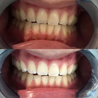 プラチナムビューティー川口店所属・プラチナム ビューティー川口店のその他イメージ