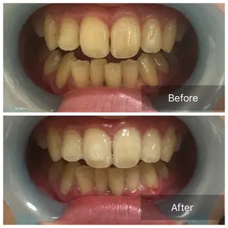 Ocouture所属・Ocouture ホワイトニング、小顔のその他イメージ