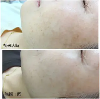 シミケア専門店 HAQUAのその他イメージ