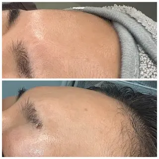 トータルしみケア専門 NICA(ニカ)のエステ・リラクイメージ