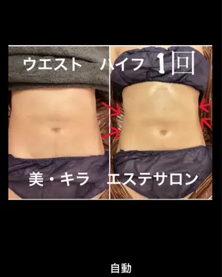 美・キラ ハイフ痩身&美肌のエステ・リラクイメージ