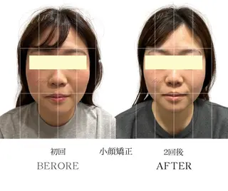 小顔・ニキビ・肌管理 TERN 南草津店のエステ・リラクイメージ