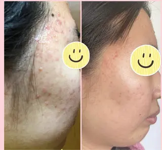 Narisビューティサロン デアイム所属・ささき ひとみのエステ・リラクイメージ