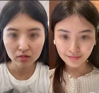 aliaハイフ&水光ジェットサロン所属・aliaハーブ水光店 エステティシャン募集のエステ・リラクイメージ