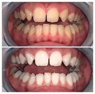 ロング ヘアアレンジ ネイル マツエク・マツパ メンズ カラー キッズ パーマ アイブロウ ライトビューティー 銀座店のエステ・リラクイメージ