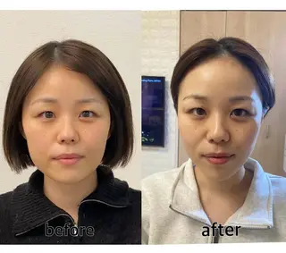 小顔矯正サロンAST【アスト】所属・小顔矯正サロン AST【アスト】のその他イメージ
