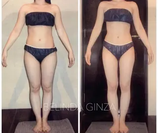 BELINDA銀座店 ✨痩身エステサロン✨のエステ・リラクイメージ