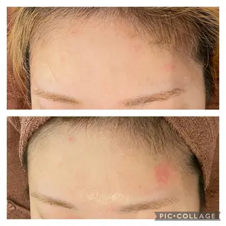 ミディアム カラー パーマ ヘアアレンジ メンズ キッズ ネイル マツエク・マツパ アイブロウ ニキビ特化型エステ 🍓最短で肌質改善のエステ・リラクイメージ