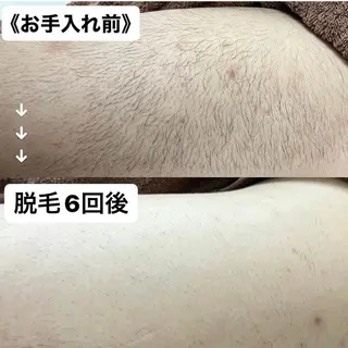 MINOA熊本店所属・MINOA 熊本店のエステ・リラクイメージ